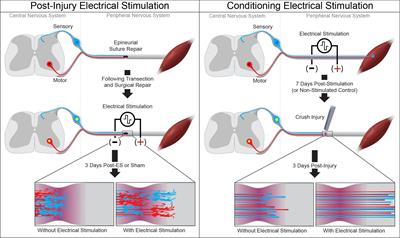 Functional Electrical Stimulation and the Modulation of the Axon Regeneration Program